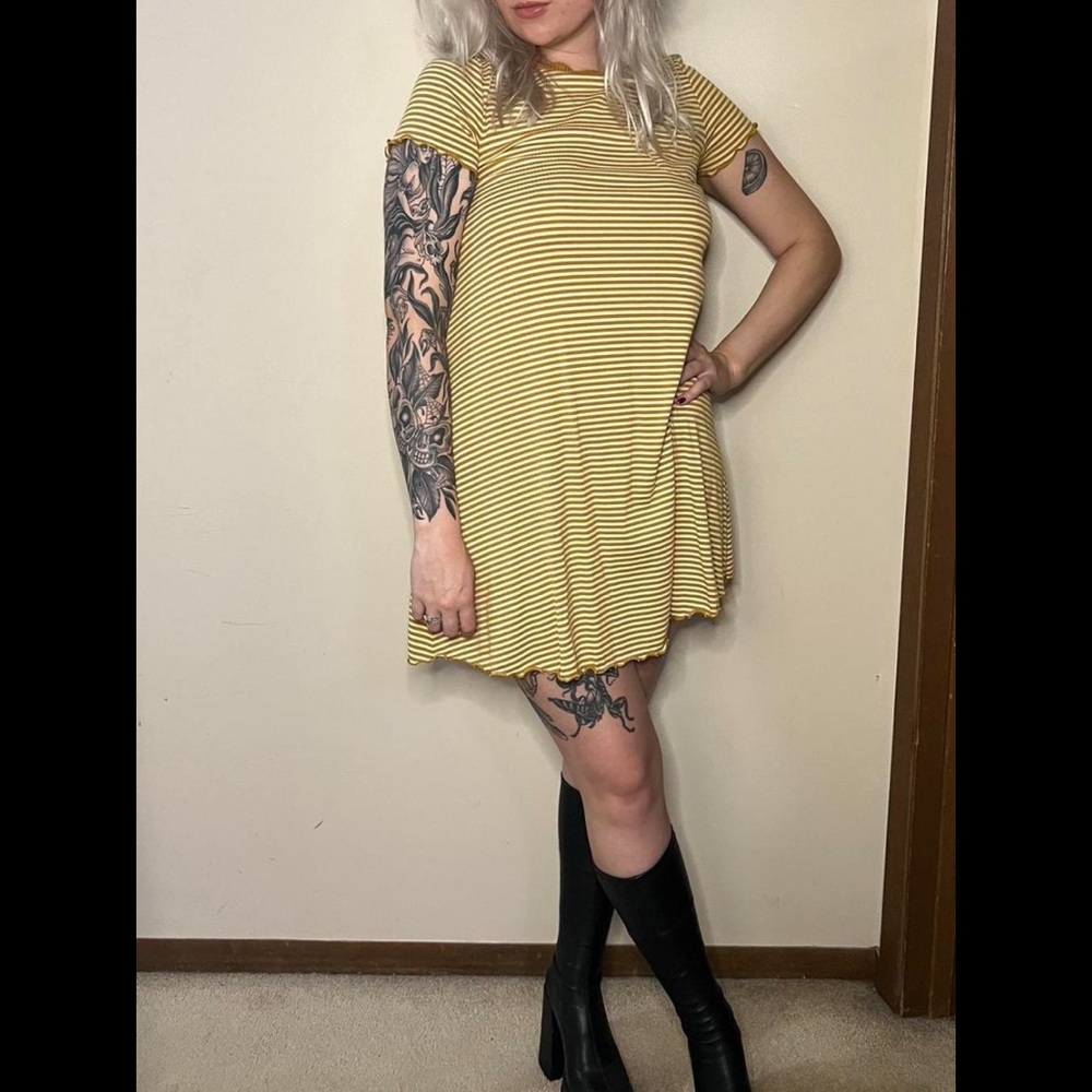 SO Yellow Striped Mini Dress